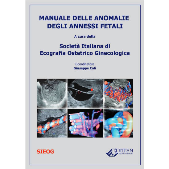 MANUALE DELLE ANOMALIE DEGLI ANNESSI FETALI